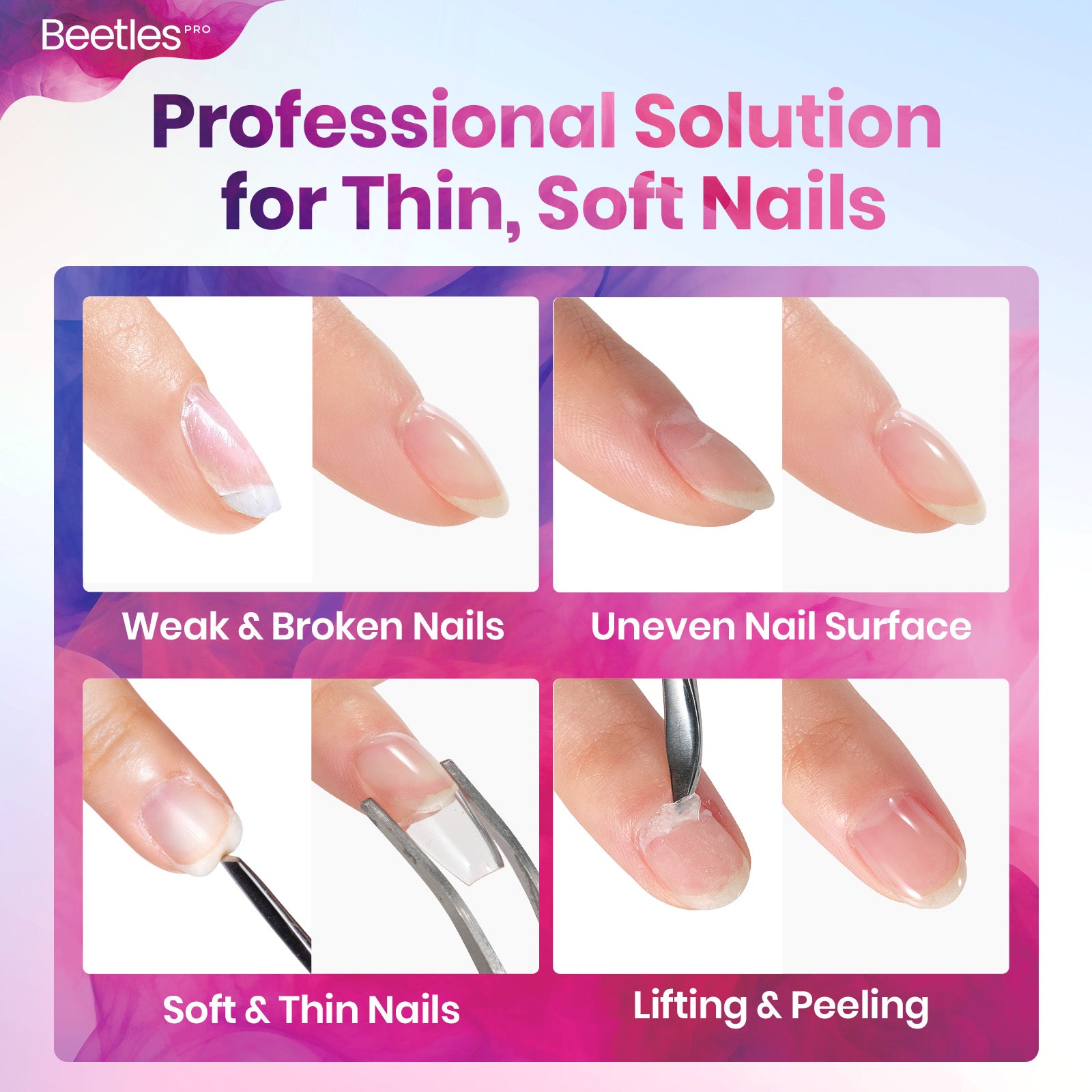 Beetles Pro HEMA Free TPO Free Floform Builder