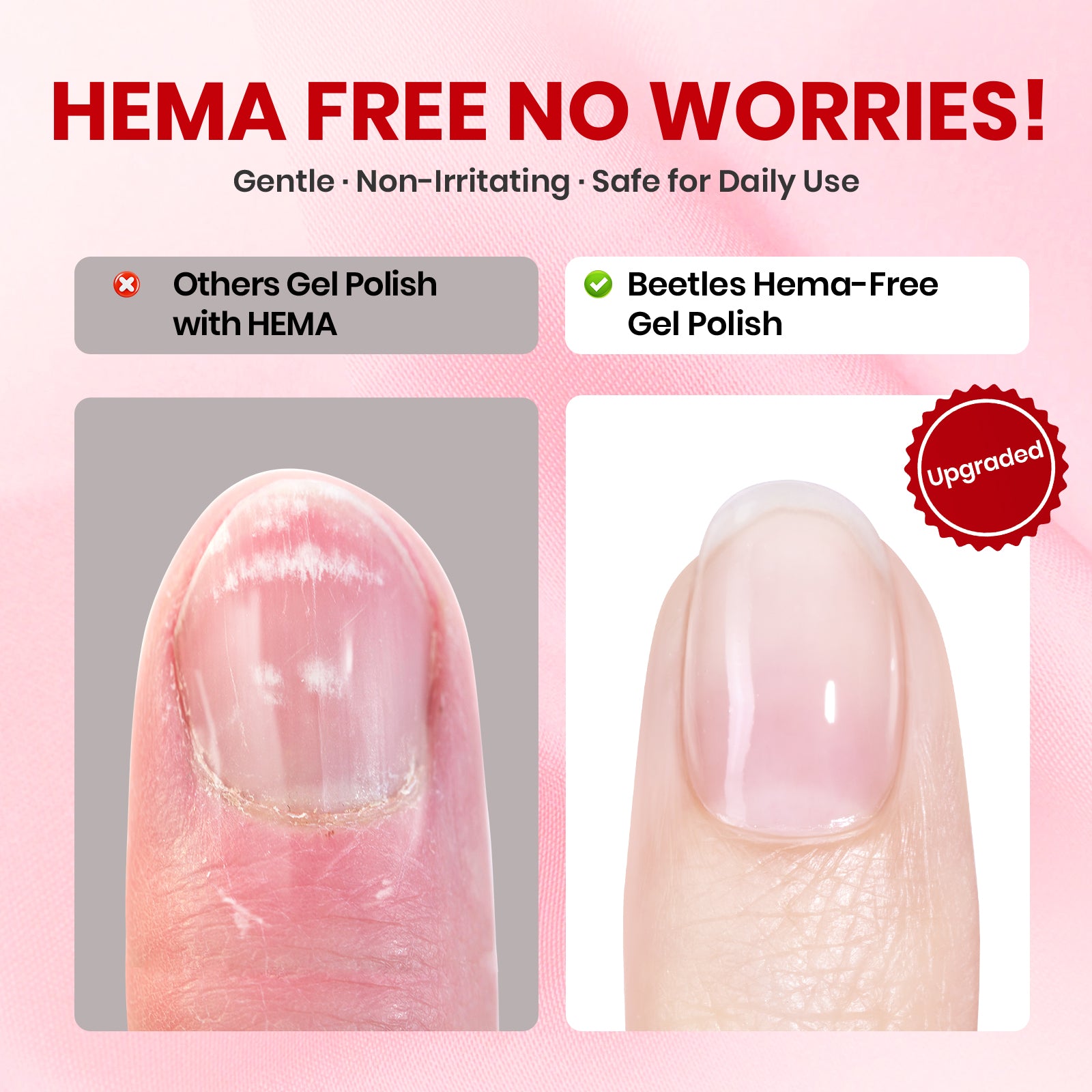 Beetles Stay Shining Timeless Charm HEMA-FREE TPO FREE Gel Nail Kit with UV Light, DIY Salon-Quality at Home