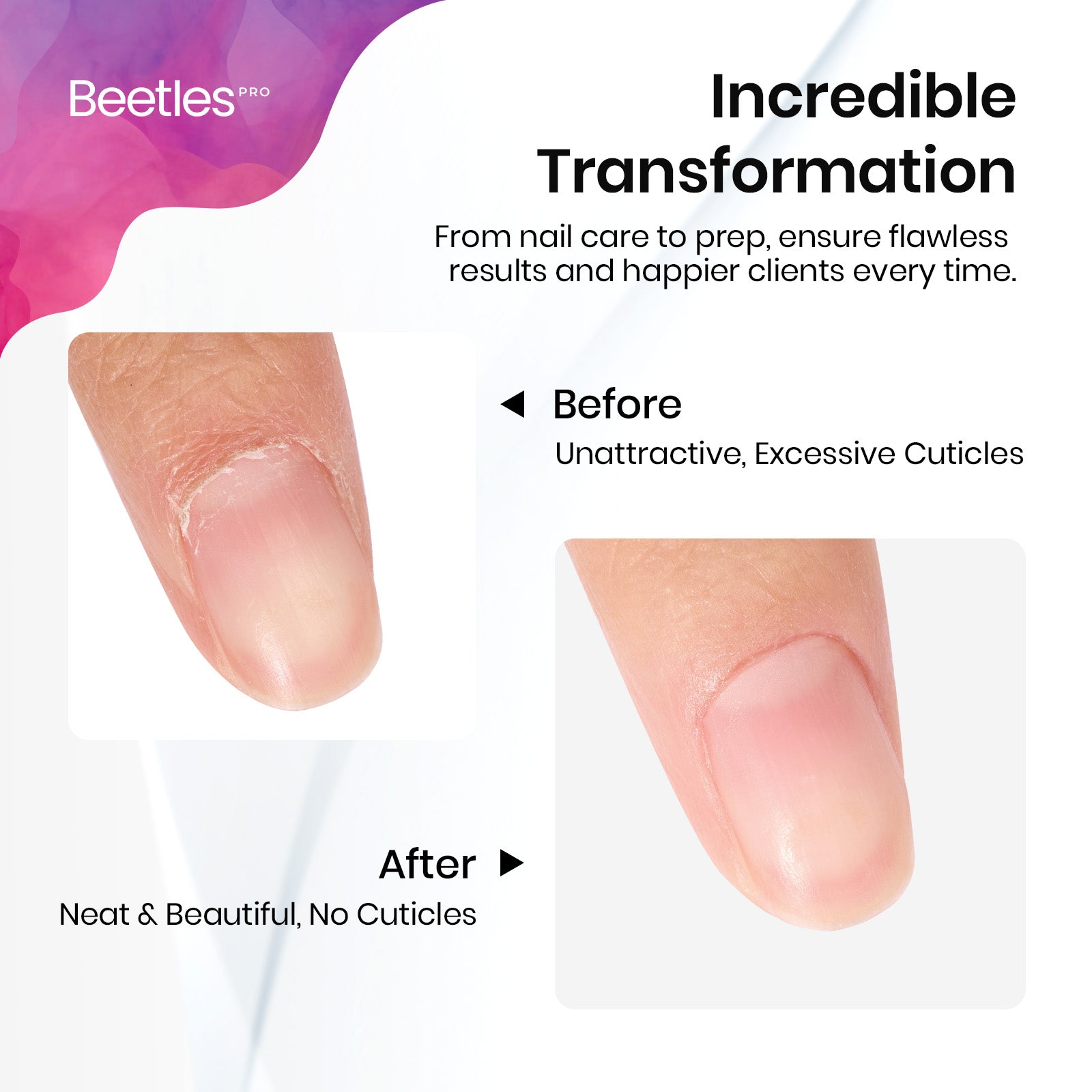 Beetles Pro Cuticle Trimmer Straight Pusher(14mm) & Straight Blade(15mm)