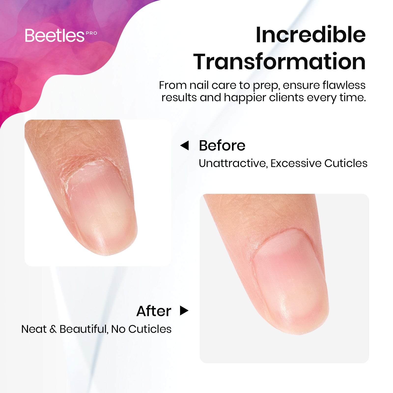 Beetles Pro Cuticle Trimmer Beveled Pusher (9mm) & Loop Pusher (23mm)